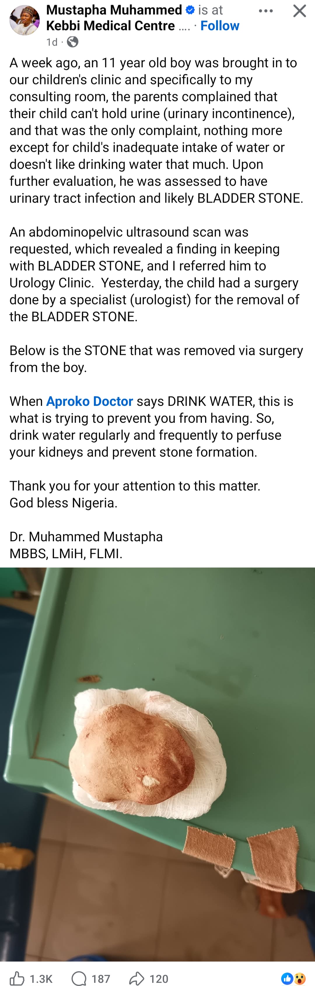Doctor shows what was found in body of boy who refuses to drink water