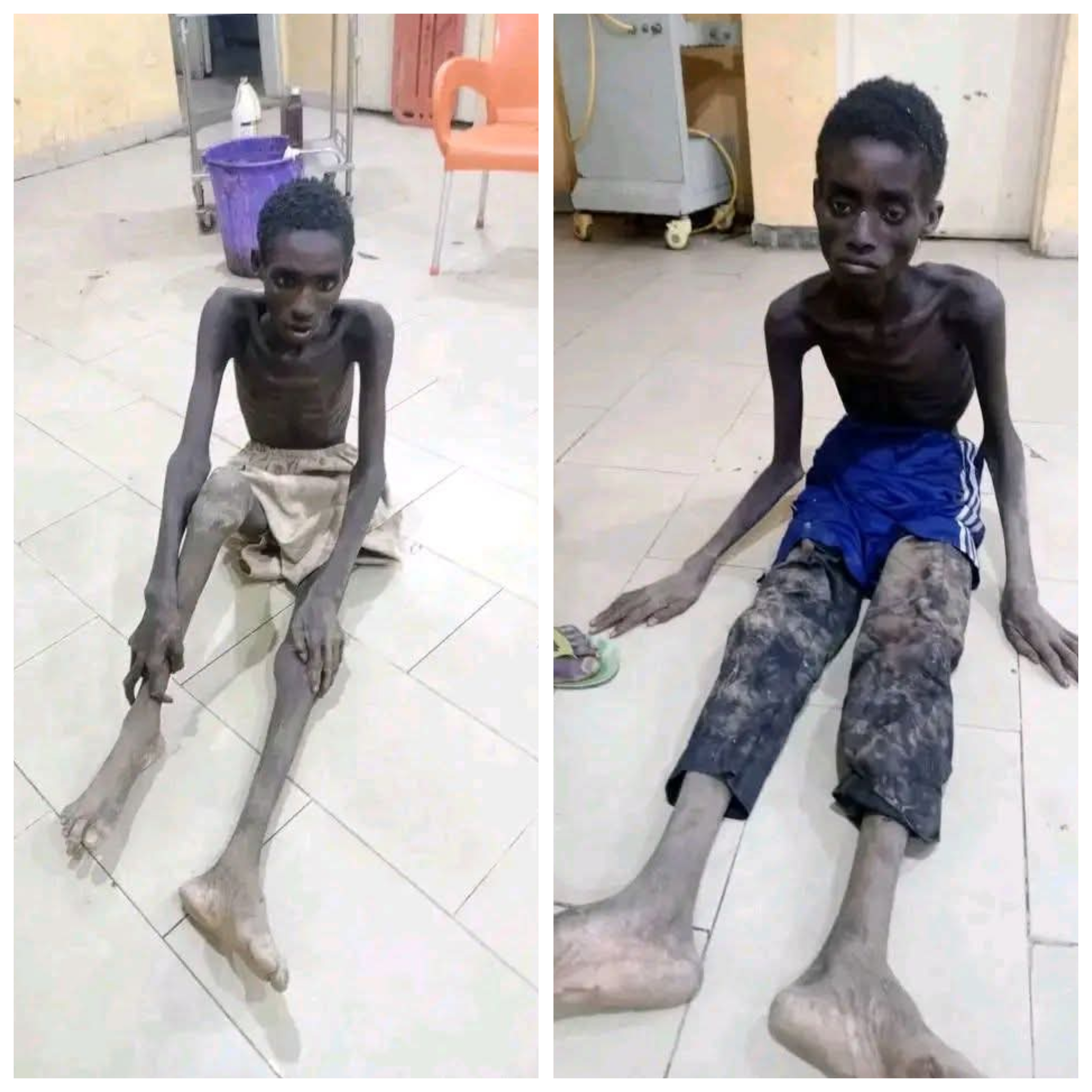 They are a testimony to failed governance - Katsina man writes as he shares haunting photos of two recently released kidnapped victims looking emaciate